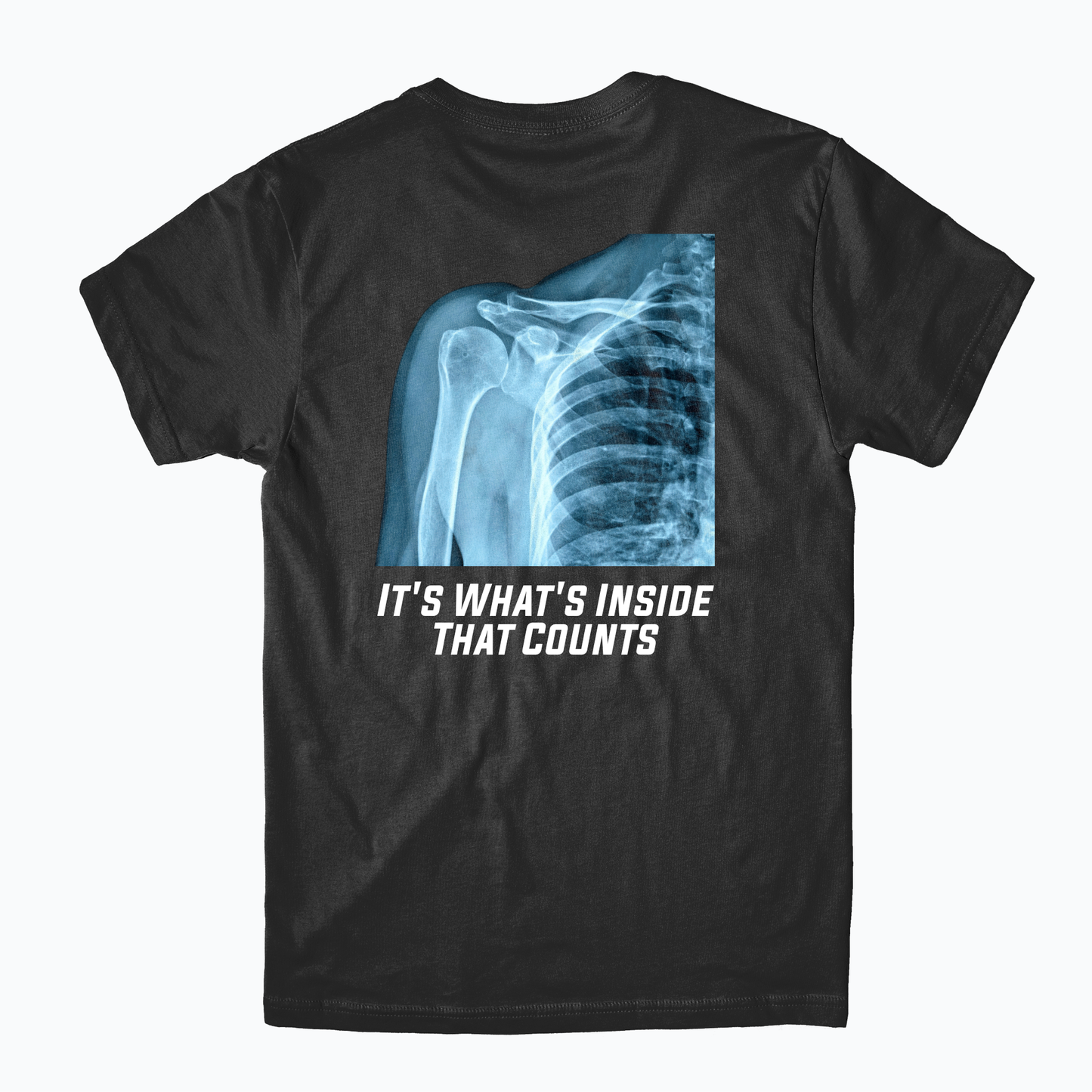 RADIOLOGY | RAD RN TEE